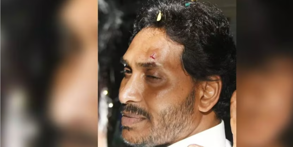 andhra pradesh cm jagan mohan reddy suffers injury during roadshow