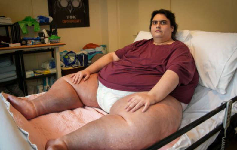 weighing 317 kg; Britain's heaviest man meets tragic end