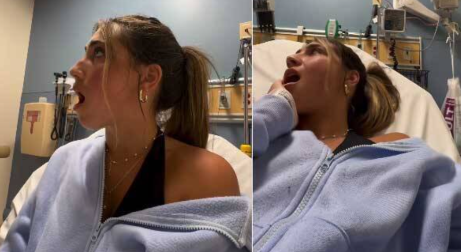 us influencer gets her jaw stuck wide open after yawning