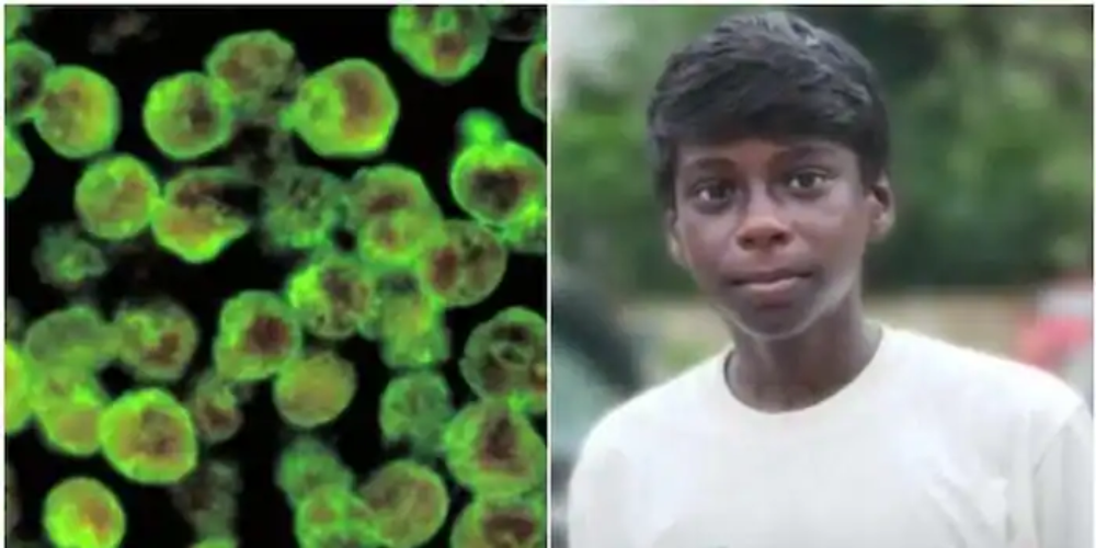 kozhikode-14-year-old-mrudul died-of-amoebic-meningoencephalitis