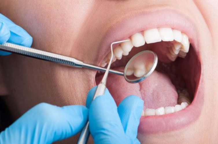 These three foods can damage your teeth